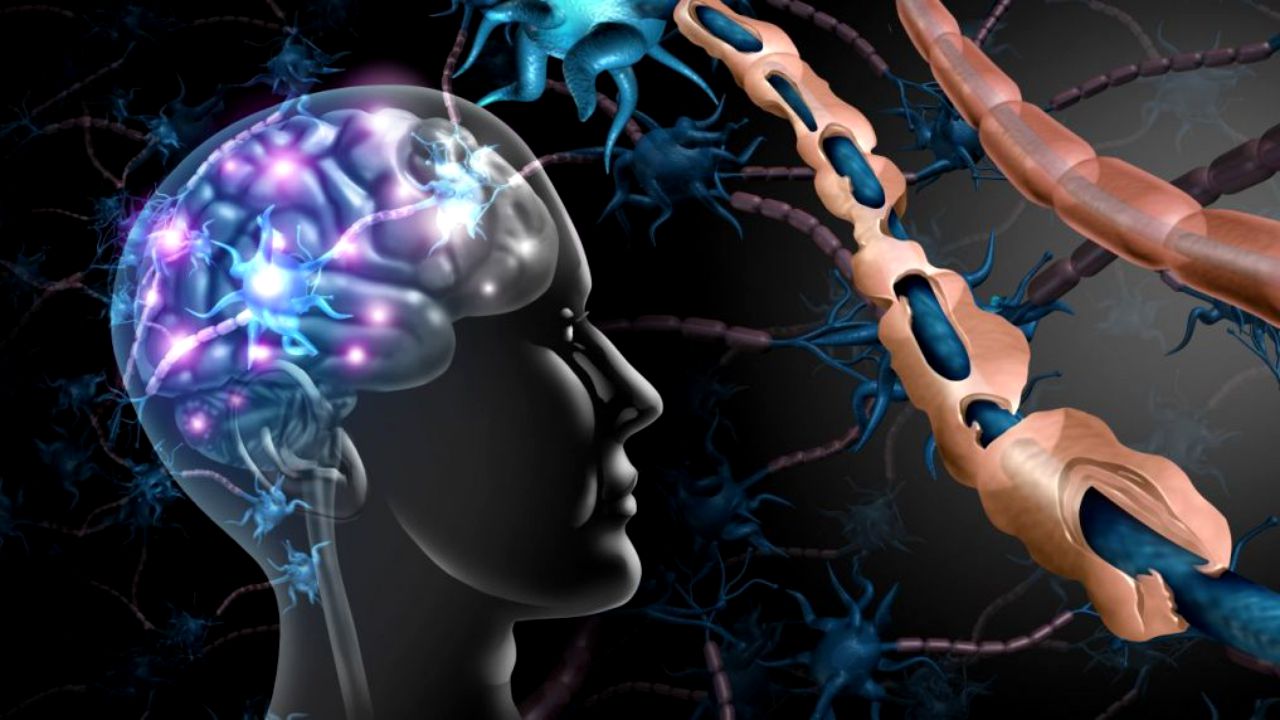 ماذا تعرف عن أسباب التصلب اللويحي وأعراضه؟