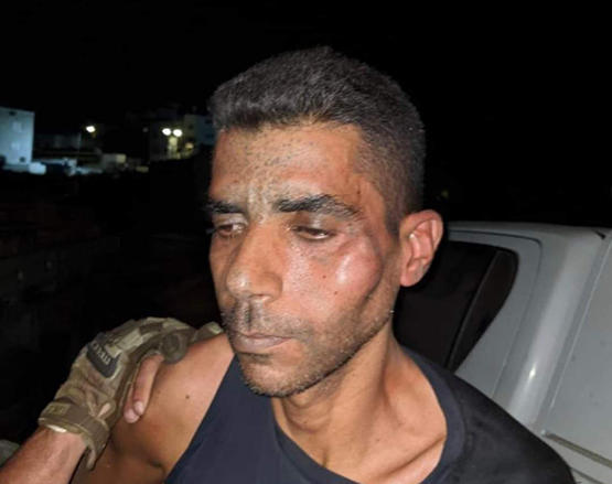 الاحتلال ينهال بالضرب على الزبيدي