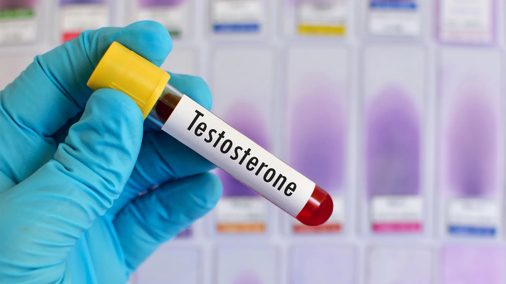 Low testosterone: Symptoms, causes, and when to seek help