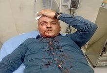 Photo of Journalist Habashneh assaulted outside his home, hospitalized